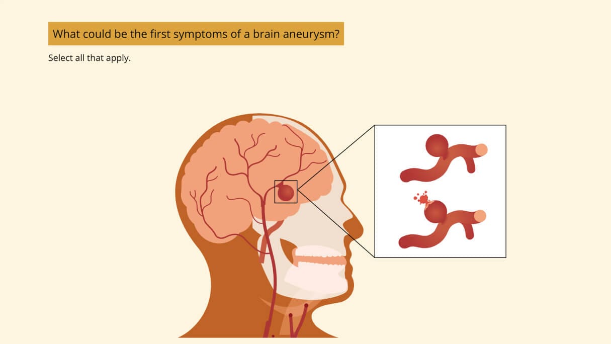 A slide within the course that reads, "What could be the first symptom of a brain aneurysm?"